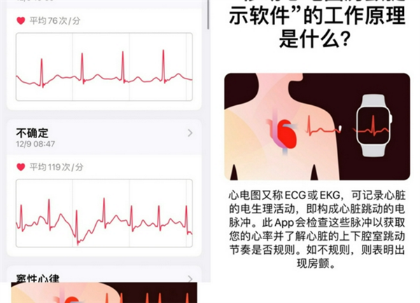 iOS 15.2發(fā)布后:國(guó)行Apple Watch用戶期待ECG功能上線快升級(jí) iOS 15.2發(fā)布后:國(guó)行Apple Watch用戶期待ECG功能上線快升級(jí)
